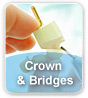 Crown And Bridge Crown And Bridge