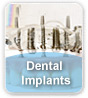 Dental Implants Dental Implants