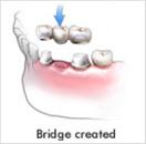 Bridge Created