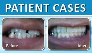 Patient Case 1