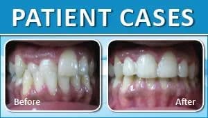 Patient Case 2