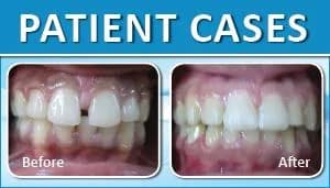 Patient Case 4