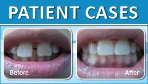 Patient Case 5