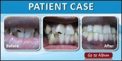 Patient Case 6