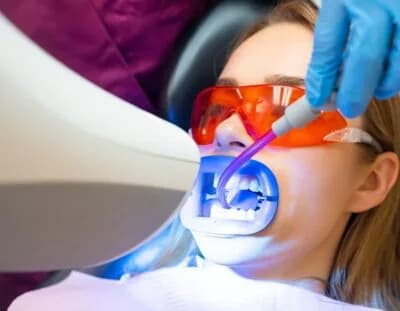 Laser Teeth Whitening