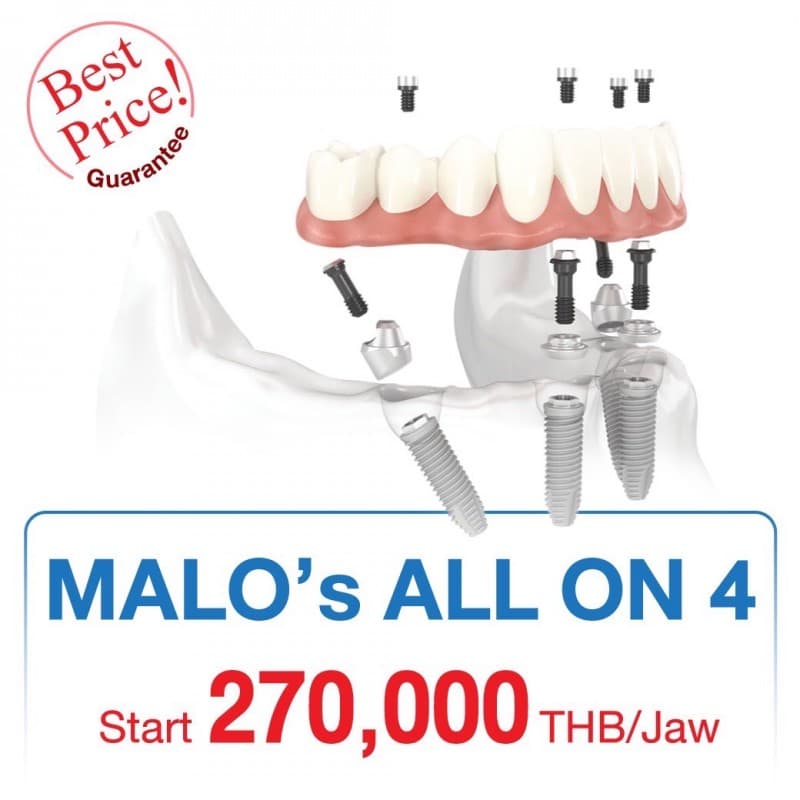 MALO’s ALL ON 4