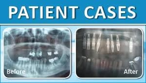 Patient Case 2