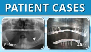 Patient Case 6
