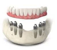 Concept – A dental