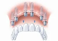 Concept – B dental