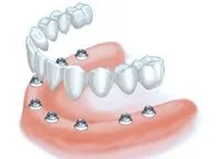 Concept – D dental