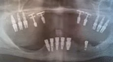 Patient case 1