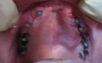 Patient case 2