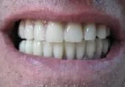 Patient case 3
