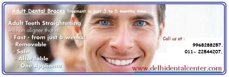Clear aligners