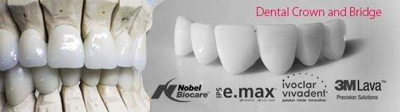 dental-crown-and-bridge