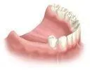 1st visit : Dental Consultation, Examination and X-Rays.