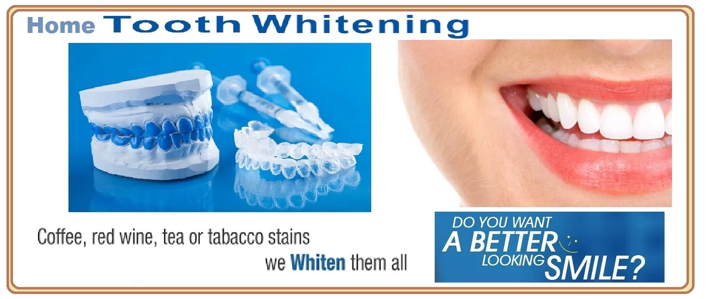 home-bleaching