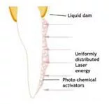 led-whitening