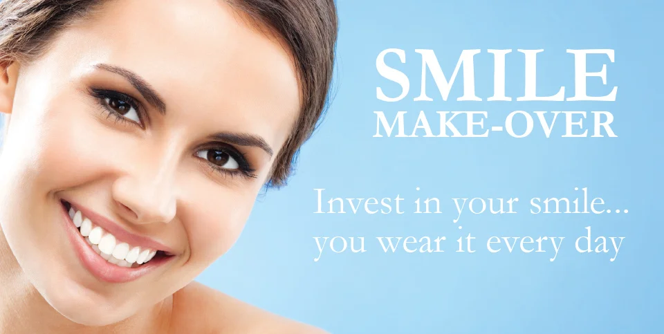 Smile Makeover
