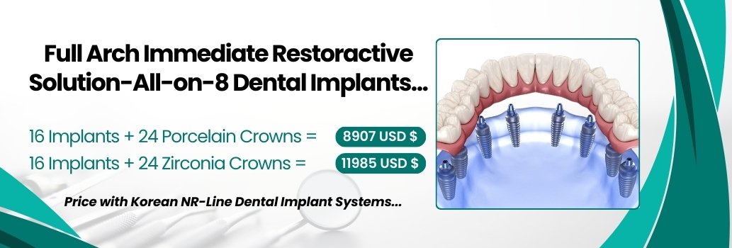All on 8 Korean Implant