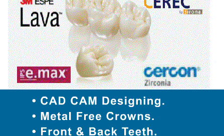 3M Lava crown India