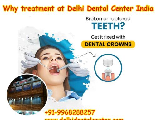 Why treatment at Delhi Dental Center