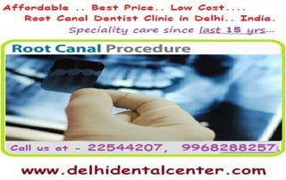 Painless root canal treatment in East Delhi