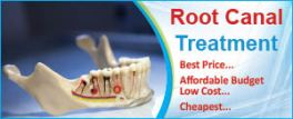Root Canal Treatment1
