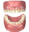 Orthodontic Braces treatments Delhi India