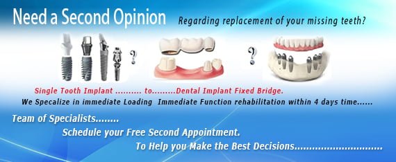 Dental Implant