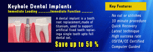 Keyhole-Dental-Implants