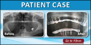 Patient Case