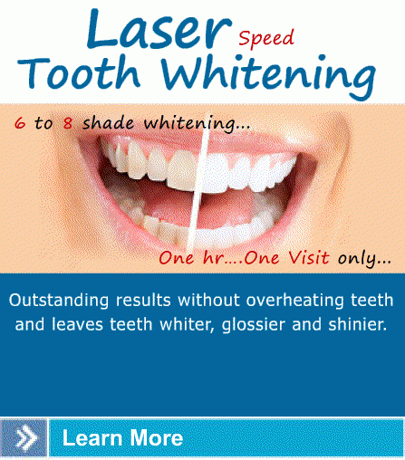 laser tooth whitening