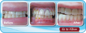 Patient Case