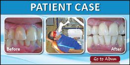 Patient Case