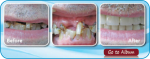Patient Case