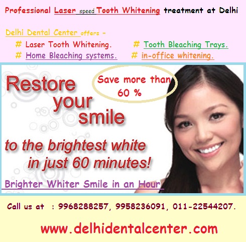 Dental_Whitening_Delhi_Dental_Center.