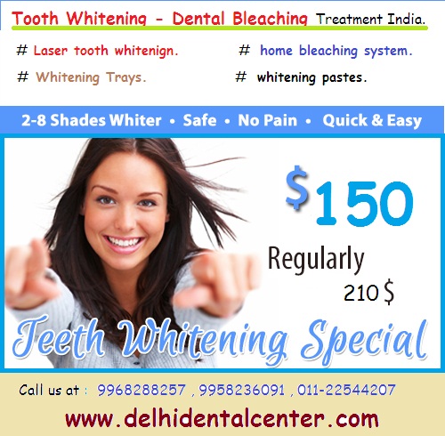 Tooth_Teeth_Whitening_Delhi_India.
