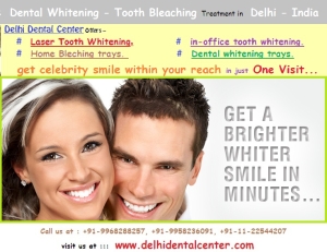 laser-tooth-whitening-Delhi-India.