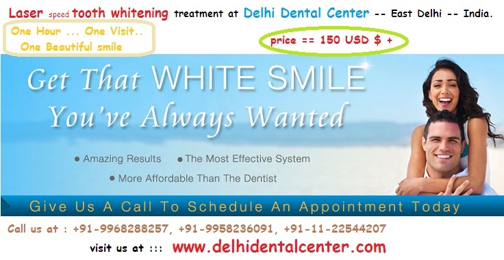 tooth_whitening_treatemtn_in_Delhi_India.