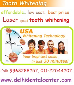 tooth_whitening_treatment_Delhi_India.