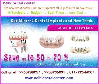 All-on-4 implants Delhi Dental Center - India.