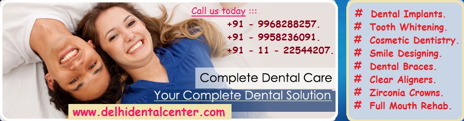 Dental Braces Dentist East Delhi