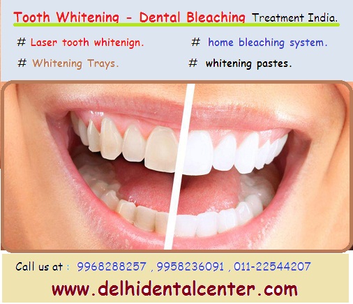 delhi-dental-center-tooth-whitening-promotion-banner.