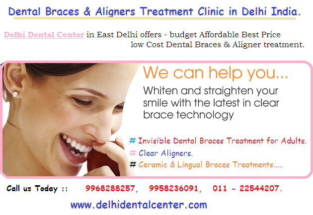 Dental Braces Treatment in East Delhi, India