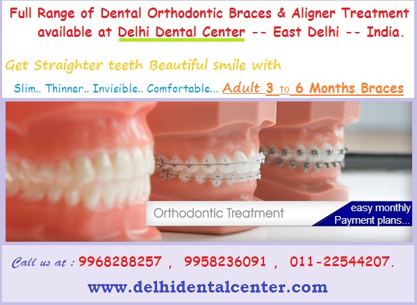 dental-braces-treatment-east-delhi-banner.