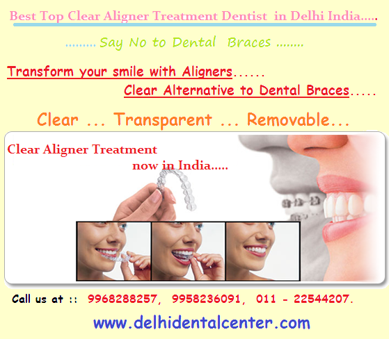 Dental Braces TreatmentDental Braces Treatment in East Delhi, India in East Delhi, India