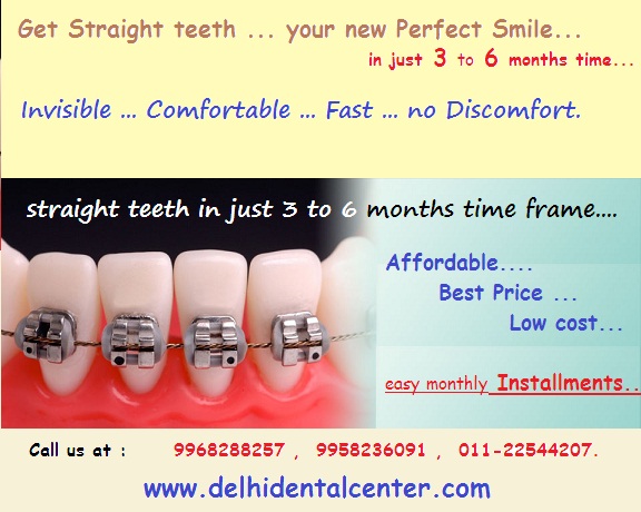 orthodontic-treatment -Delhi-India_banner