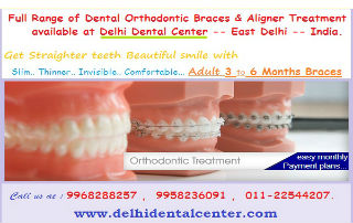 Dental Braces Delhi India